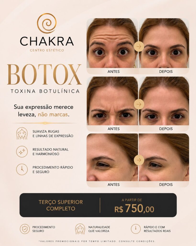 ão espere a ruga dinâmica virar estática. Em Santo André, nosso protocolo de Toxina Botulínica foca no gerenciamento preventivo da face. Utilizamos a técnica de microdosagem para preservar sua expressão, suavizando o terço superior com naturalidade. Planeje sua melhor versão a longo prazo. Agende sua análise clínica.